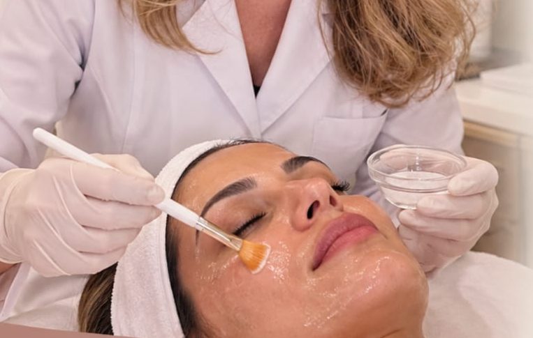Aplicação de peeling químico com pincel no rosto de uma paciente.